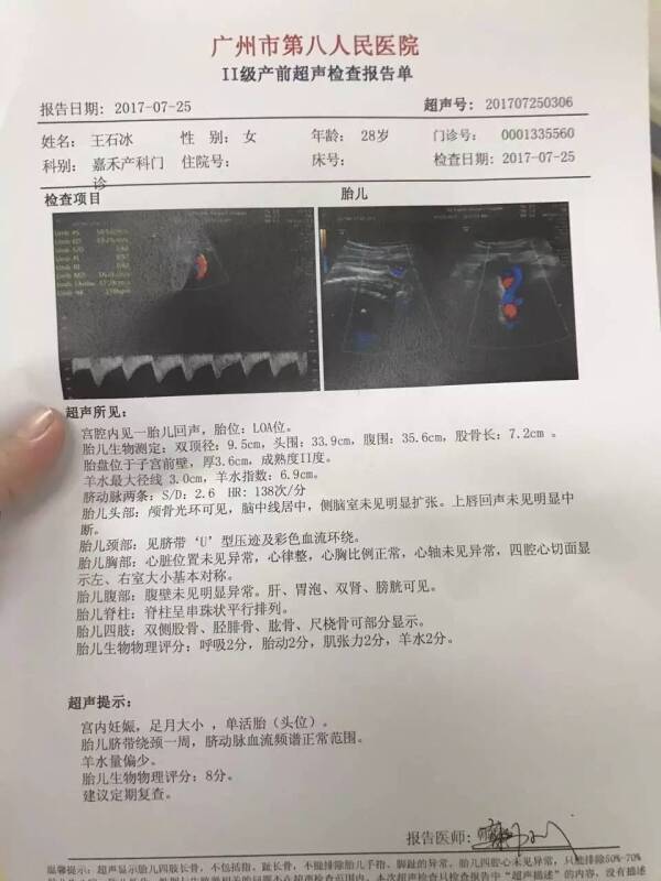 关键词：广州市八医院延误剖腹产致婴儿窒息亡，及其他