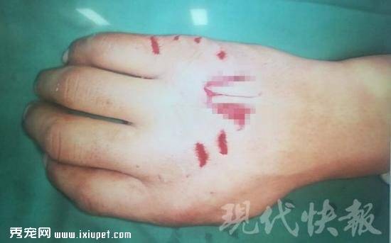徐州男子养宠物鳄鱼突遭击袭击致手背撕裂