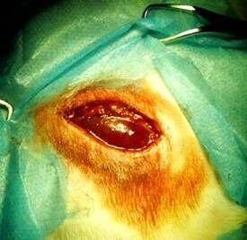 一例犬咬伤病例分析