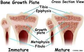 一例犬骨骺端骨折病例